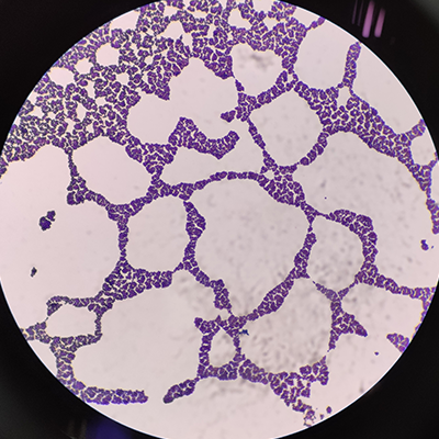 Real staphylococcus gram positive cocci shape bacteria under microscope